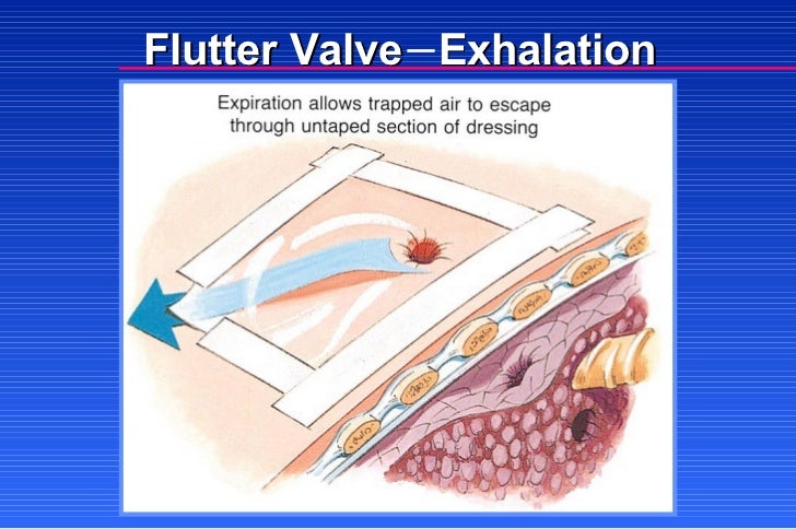 Soft Tissue Injuries