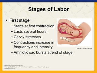 Stages of Labor
• First stage
− Starts at first contraction
− Lasts several hours
− Cervix stretches.
− Contractions increase in
frequency and intensity.
− Amniotic sac bursts at end of stage.
© Jones & Bartlett Learning.
 