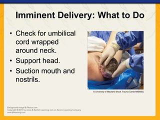 Imminent Delivery: What to Do
• Check for umbilical
cord wrapped
around neck.
• Support head.
• Suction mouth and
nostrils.
© University of Maryland Shock Trauma Center/MIEMSS.
 