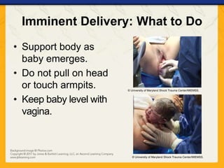 Imminent Delivery: What to Do
• Support body as
baby emerges.
• Do not pull on head
or touch armpits.
• Keep baby level with
vagina.
© University of Maryland Shock Trauma Center/MIEMSS.
© University of Maryland Shock Trauma Center/MIEMSS.
 
