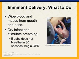 Imminent Delivery: What to Do
• Wipe blood and
mucus from mouth
and nose.
• Dry infant and
stimulate breathing.
− If baby does not
breathe in 30
seconds, begin CPR.
© University of Maryland Shock Trauma Center/MIEMSS.
 