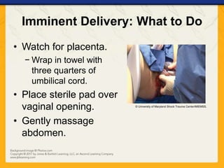 Imminent Delivery: What to Do
• Watch for placenta.
− Wrap in towel with
three quarters of
umbilical cord.
• Place sterile pad over
vaginal opening.
• Gently massage
abdomen.
© University of Maryland Shock Trauma Center/MIEMSS.
 