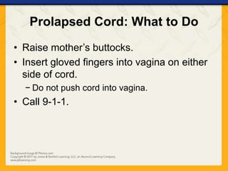 Prolapsed Cord: What to Do
• Raise mother’s buttocks.
• Insert gloved fingers into vagina on either
side of cord.
− Do not push cord into vagina.
• Call 9-1-1.
 