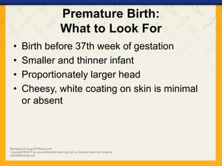 Premature Birth:
What to Look For
• Birth before 37th week of gestation
• Smaller and thinner infant
• Proportionately larger head
• Cheesy, white coating on skin is minimal
or absent
 