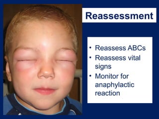 Reassment Signs Chapter 22 Toxicologic Emergencies for EMT | PPTX