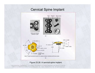 Cervical Spine Implant 
Figure 23.28 A cervical spine implant. 
Manufacturing, Engineering & Technology, Fifth Edition, by Serope Kalpakjian and Steven R. Schmid. 
ISBN 0-13-148965-8. © 2006 Pearson Education, Inc., Upper Saddle River, NJ. All rights reserved. 
