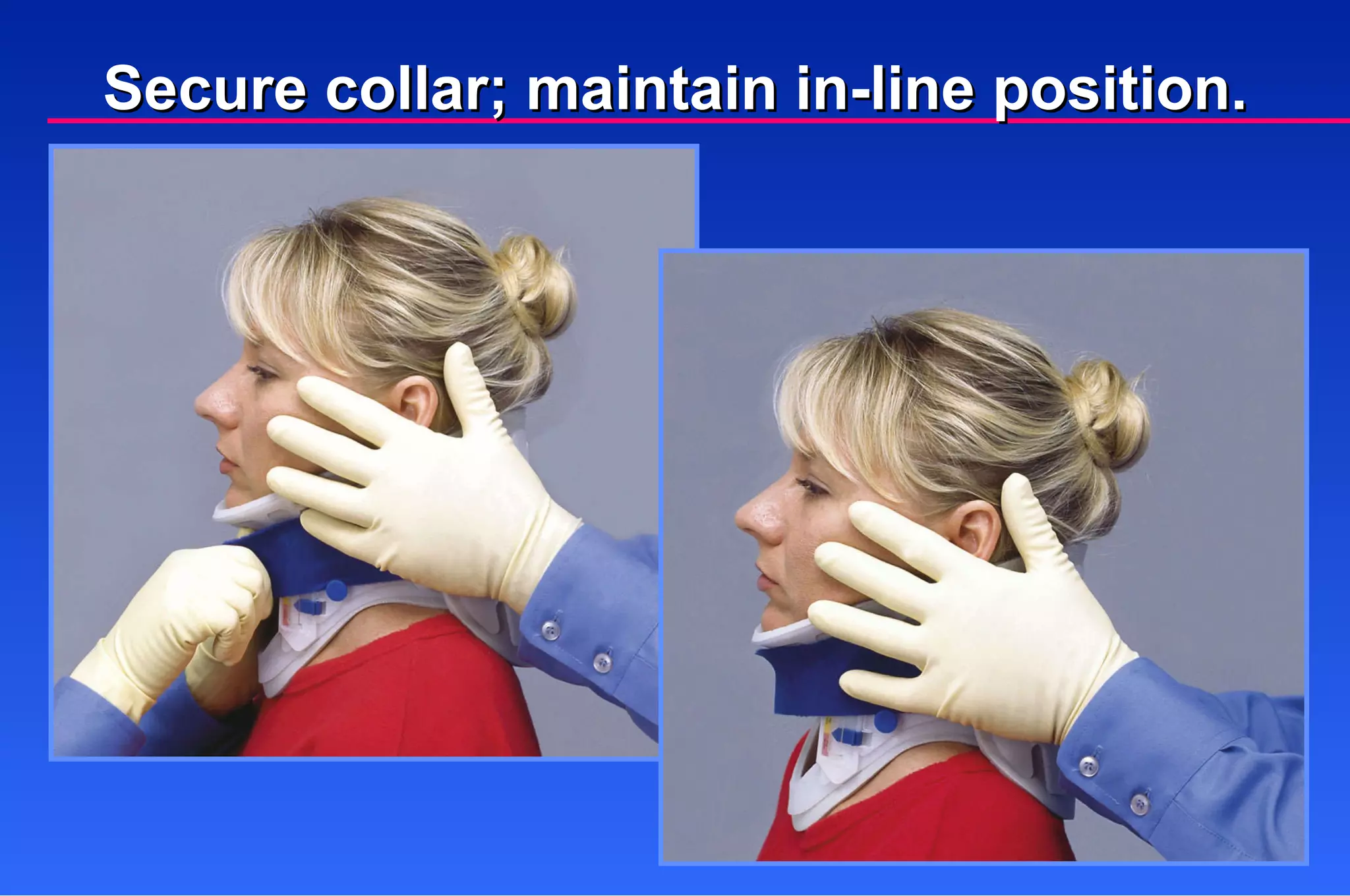 Secure collar; maintain in-line position. 