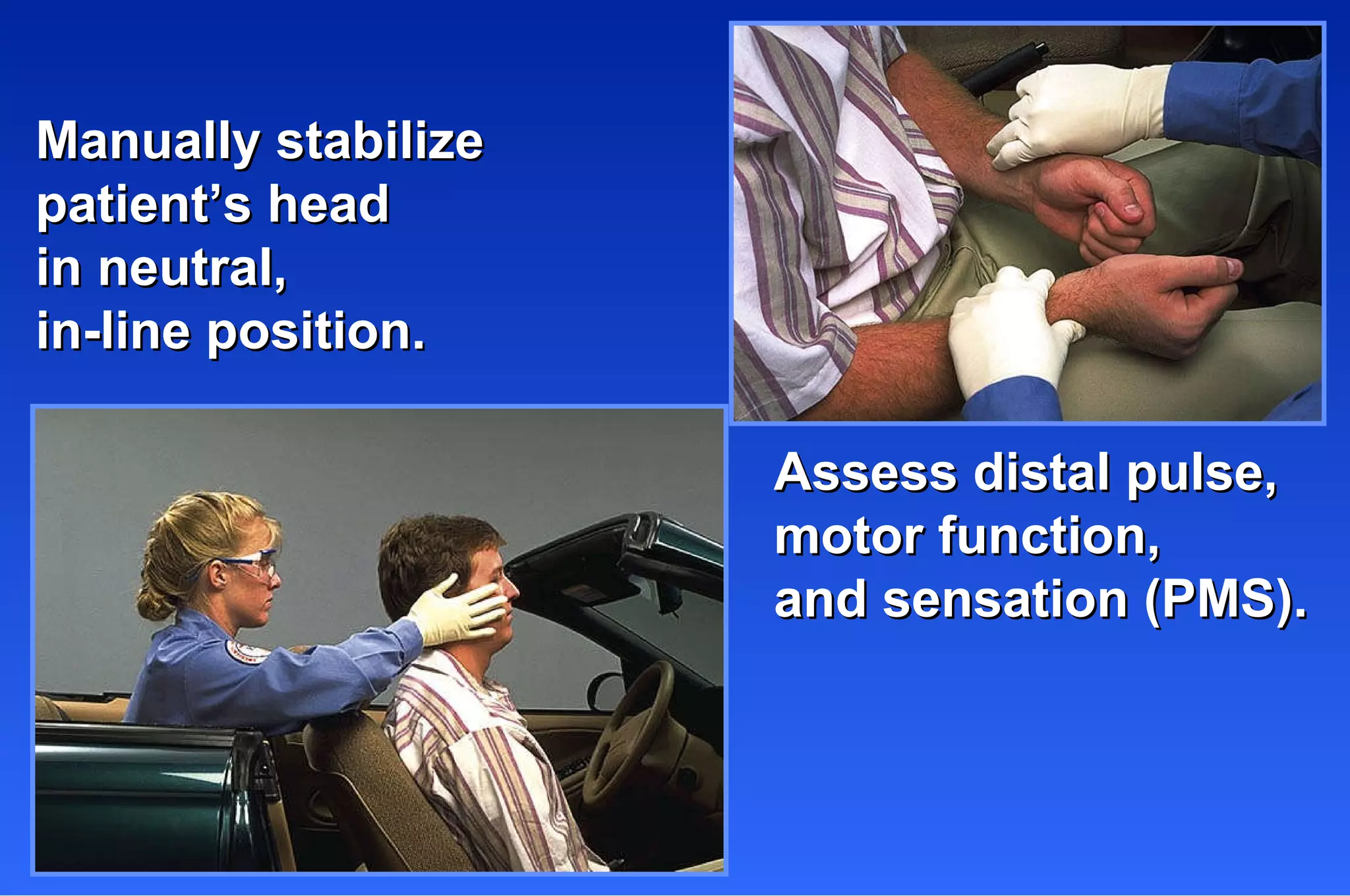 Manually stabilize  patient’s head in neutral,  in-line position. Assess distal pulse, motor function,  and sensation (PMS). 