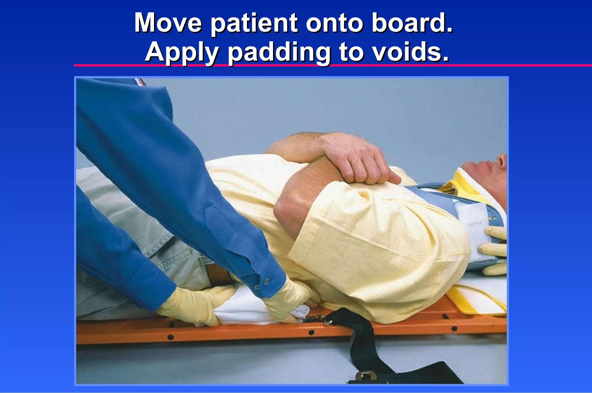 Move patient onto board.  Apply padding to voids. 