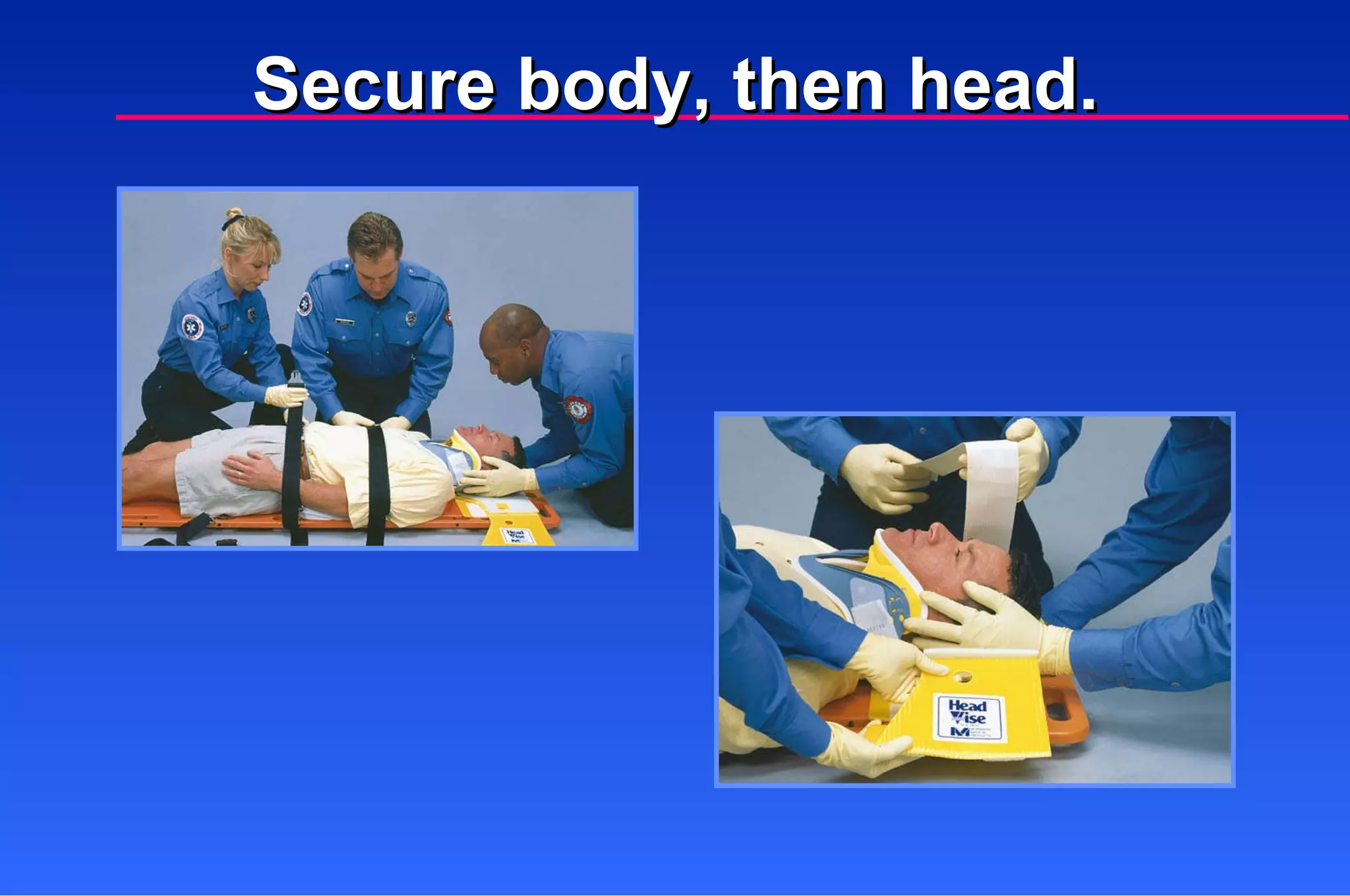 Secure body, then head. 