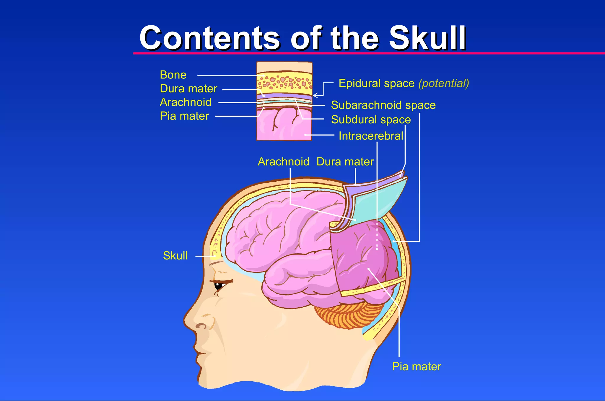 Bone Dura mater Arachnoid Pia mater Subarachnoid space Subdural space Intracerebral Dura mater Arachnoid Skull Pia mater Contents of the Skull Epidural space  (potential) 