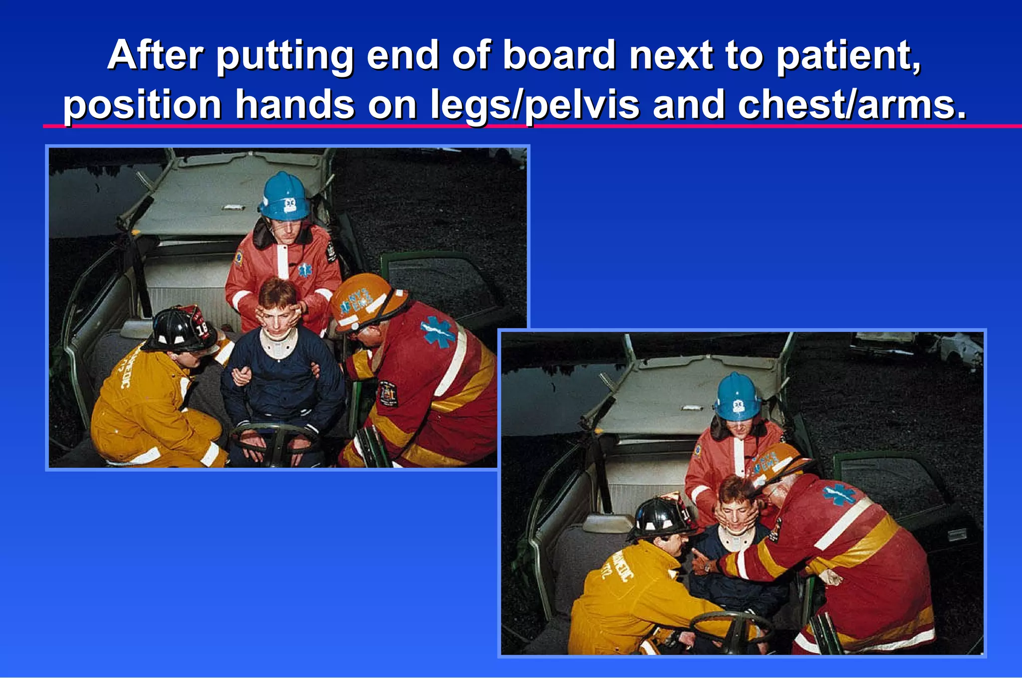 After putting end of board next to patient, position hands on legs/pelvis and chest/arms. 