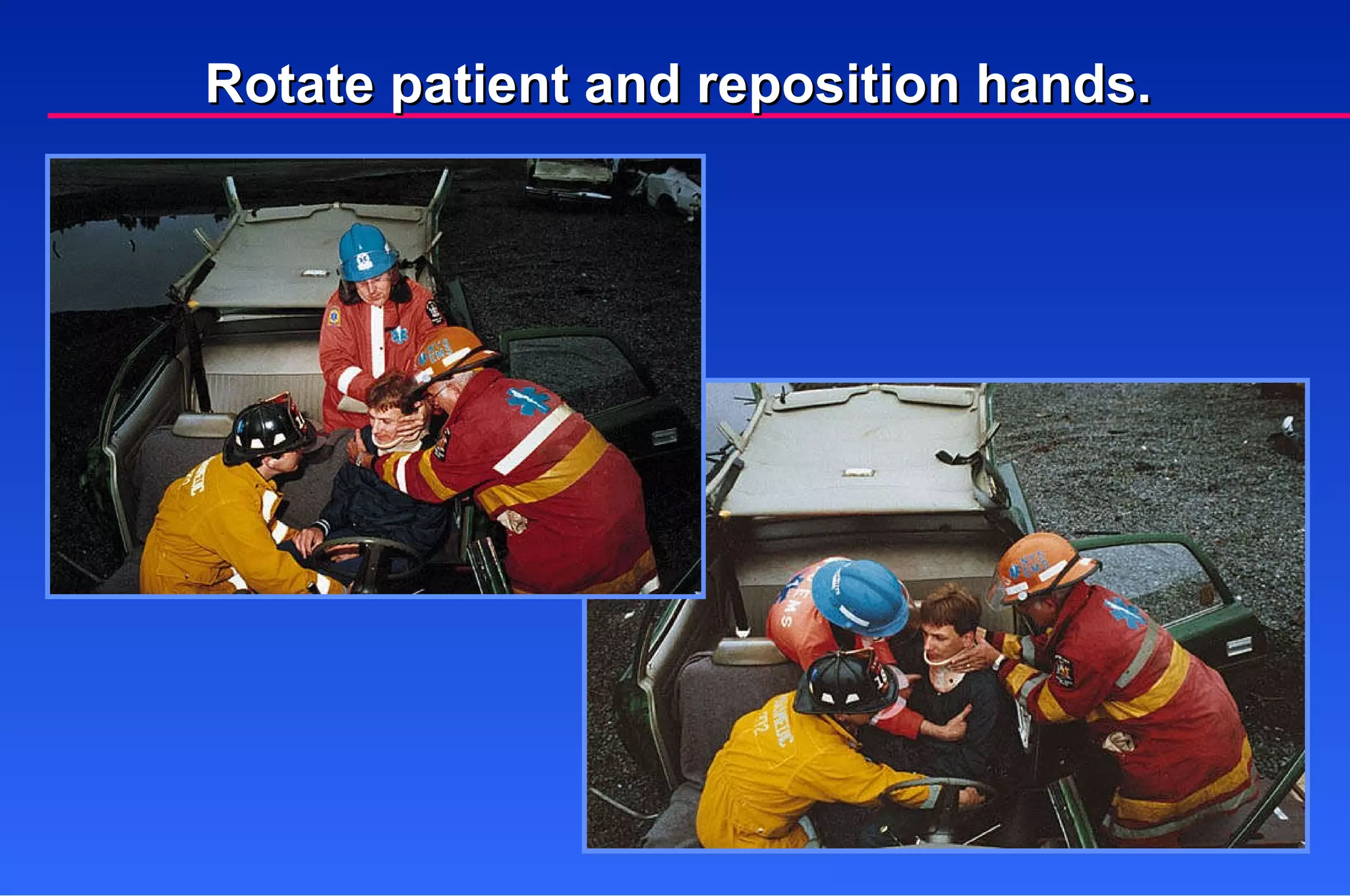 Rotate patient and reposition hands. 