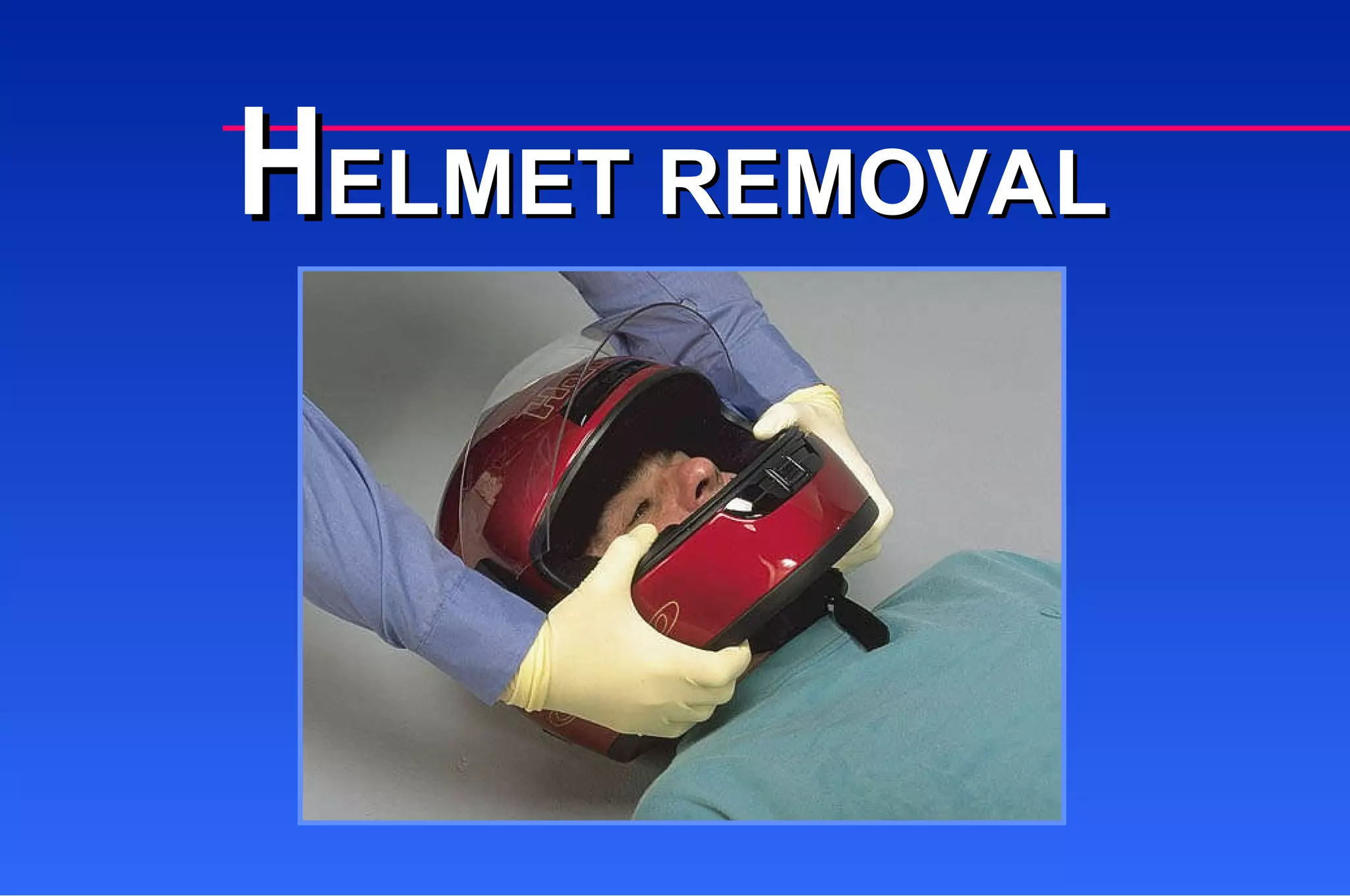 H ELMET REMOVAL 
