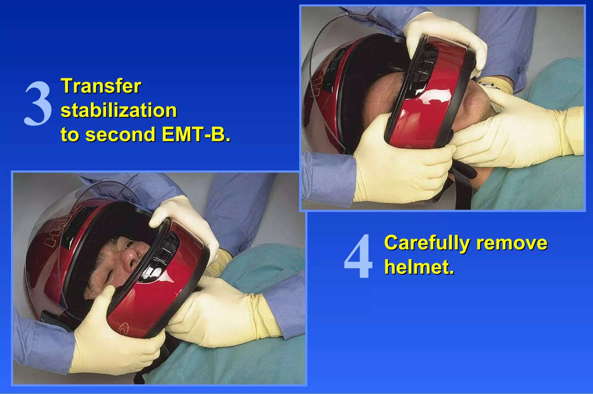 Transfer stabilization to second EMT-B. Carefully remove helmet. 3 4 
