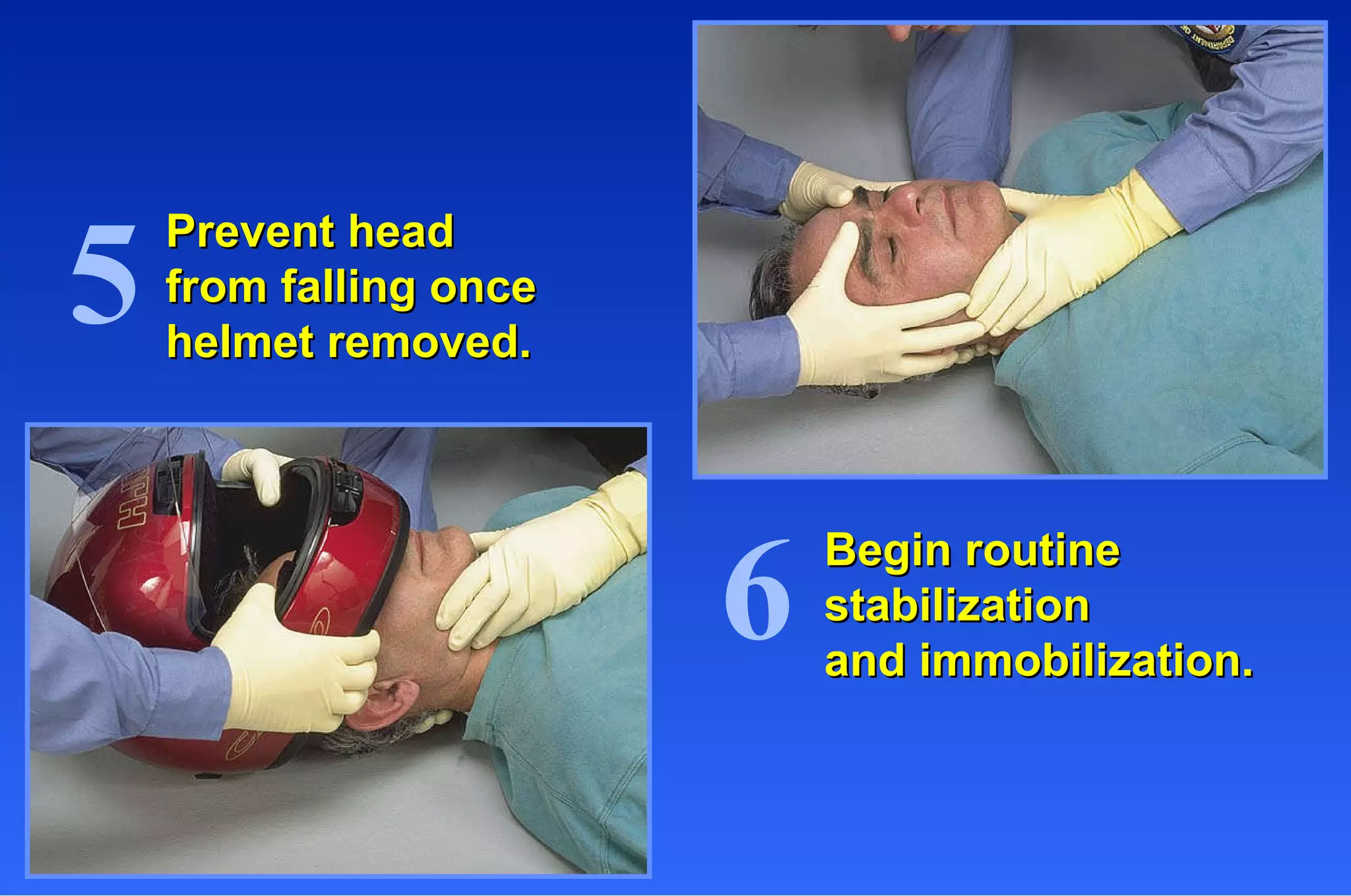 Prevent head from falling once  helmet removed. Begin routine  stabilization and immobilization. 5 6 