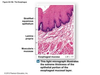 © 2012 Pearson Education, Inc.
Figure 24-10b The Esophagus
This light micrograph illustrates
the extreme thickness of the
epithelial portion of the
esophageal mucosal layer.
Esophageal mucosa LM × 77
Muscularis
mucosae
Lamina
propria
Stratified
squamous
epithelium
 