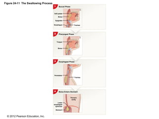 © 2012 Pearson Education, Inc.
Figure 24-11 The Swallowing Process
Buccal Phase
Pharyngeal Phase
Esophageal Phase
Bolus Enters Stomach
Stomach
Lower
esophageal
sphincter
Trachea
Peristalsis
Thoracic
cavity
Tongue
Bolus
Esophagus
Epiglottis
Bolus
Soft palate
Trachea
 