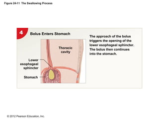 © 2012 Pearson Education, Inc.
Figure 24-11 The Swallowing Process
Bolus Enters Stomach
Stomach
Lower
esophageal
sphincter
The approach of the bolus
triggers the opening of the
lower esophageal sphincter.
The bolus then continues
into the stomach.
Thoracic
cavity
 