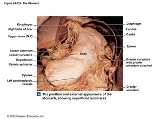 © 2012 Pearson Education, Inc.
Figure 24-12a The Stomach
The position and external appearance of the
stomach, showing superficial landmarks
Body
Fundus
Cardia
Diaphragm
Spleen
Greater curvature
with greater
omentum attached
Esophagus
Right lobe of liver
Vagus nerve (N X)
Lesser omentum
Lesser curvature
Duyodenum
Pyloric sphincter
Pylorus
Left gastroepiploic
vessels
Greater
omentum
 