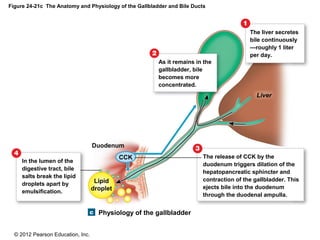 © 2012 Pearson Education, Inc.
Figure 24-21c The Anatomy and Physiology of the Gallbladder and Bile Ducts
Physiology of the gallbladder
In the lumen of the
digestive tract, bile
salts break the lipid
droplets apart by
emulsification.
Duodenum
Lipid
droplet
CCK
As it remains in the
gallbladder, bile
becomes more
concentrated.
Liver
The liver secretes
bile continuously
—roughly 1 liter
per day.
The release of CCK by the
duodenum triggers dilation of the
hepatopancreatic sphincter and
contraction of the gallbladder. This
ejects bile into the duodenum
through the duodenal ampulla.
 