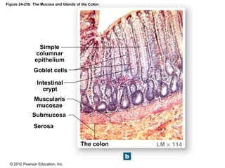 © 2012 Pearson Education, Inc.
Figure 24-25b The Mucosa and Glands of the Colon
The colon LM × 114
Serosa
Submucosa
Muscularis
mucosae
Intestinal
crypt
Goblet cells
Simple
columnar
epithelium
 