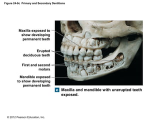 © 2012 Pearson Education, Inc.
Figure 24-9c Primary and Secondary Dentitions
Maxilla and mandible with unerupted teeth
exposed.
Mandible exposed
to show developing
permanent teeth
First and second
molars
Erupted
deciduous teeth
Maxilla exposed to
show developing
permanent teeth
 