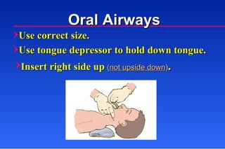 Use correct size. Use tongue depressor to hold down tongue. Insert right side up   ( not upside down ) . Oral Airways 