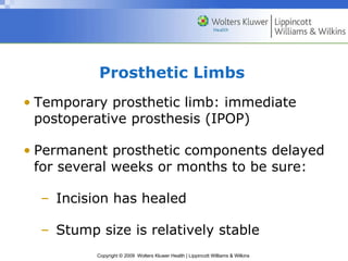 Prosthetic Limbs   Temporary prosthetic limb: immediate postoperative prosthesis (IPOP) Permanent prosthetic components delayed for several weeks or months to be sure:  Incision has healed Stump size is relatively stable 