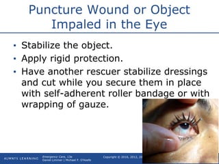 Ch26 soft tissue | PPT