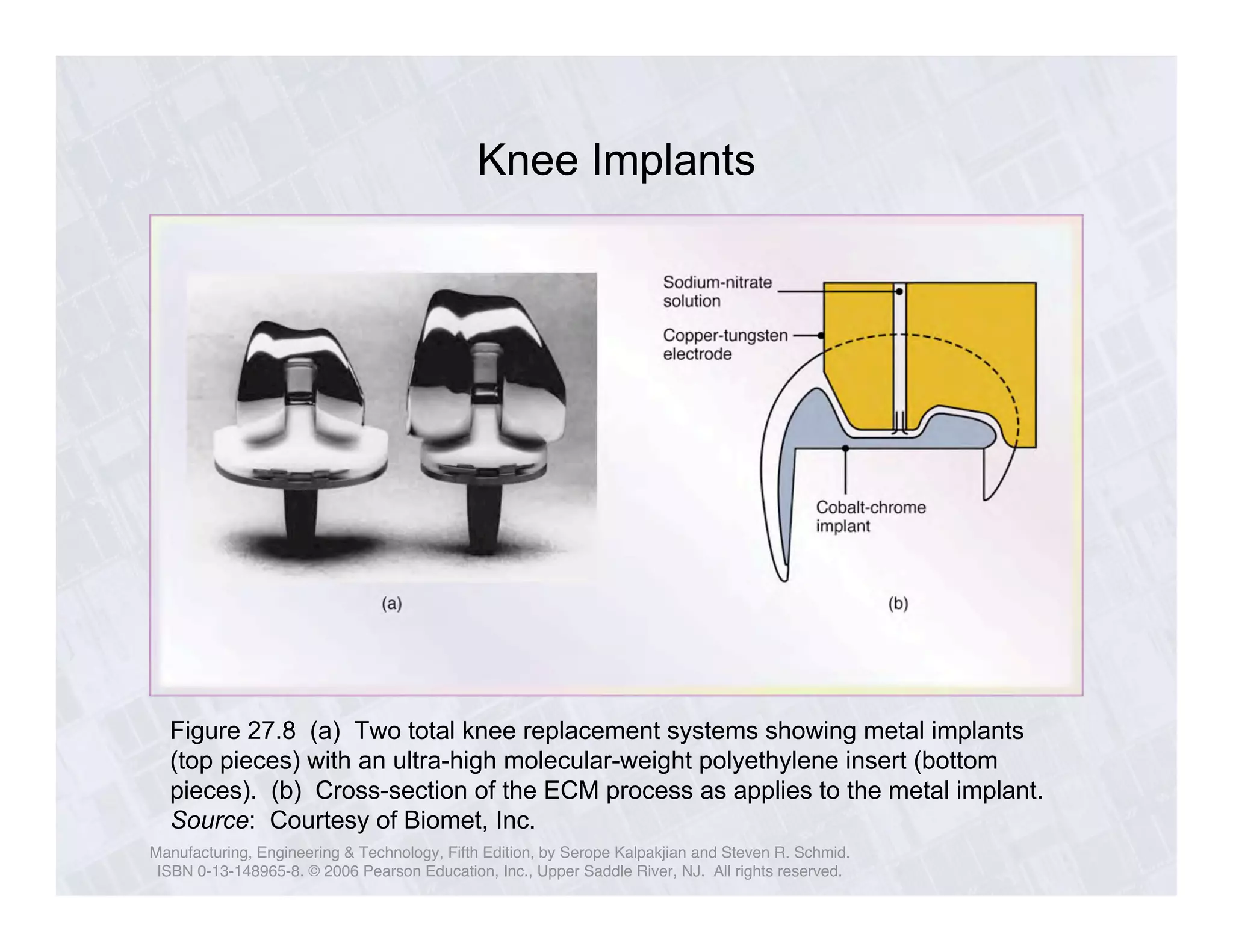 Knee Implants 
Figure 27.8 (a) Two total knee replacement systems showing metal implants 
(top pieces) with an ultra-high molecular-weight polyethylene insert (bottom 
pieces). (b) Cross-section of the ECM process as applies to the metal implant. 
Source: Courtesy of Biomet, Inc. 
Manufacturing, Engineering & Technology, Fifth Edition, by Serope Kalpakjian and Steven R. Schmid. 
ISBN 0-13-148965-8. © 2006 Pearson Education, Inc., Upper Saddle River, NJ. All rights reserved. 
 