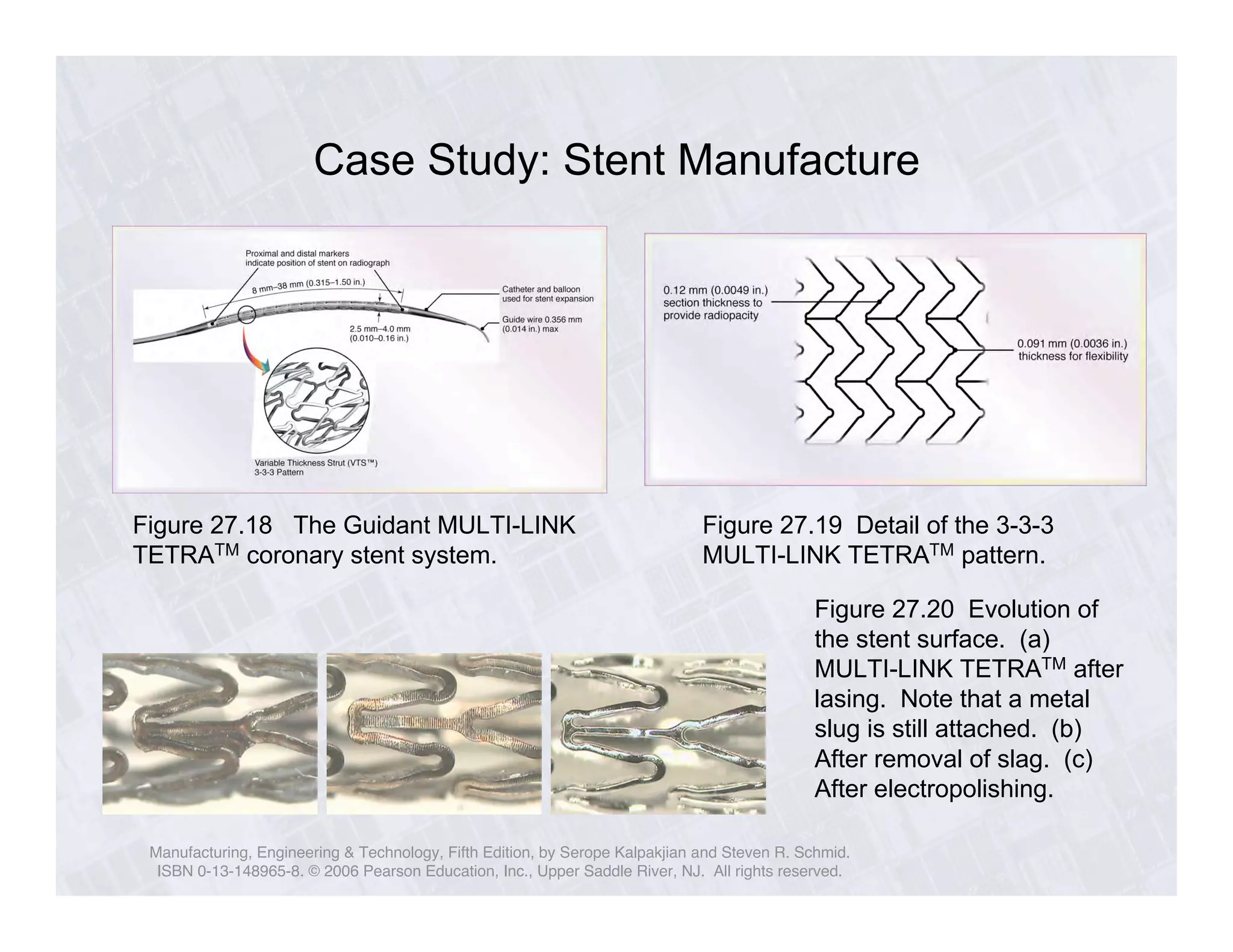 Case Study: Stent Manufacture 
Figure 27.18 The Guidant MULTI-LINK 
TETRATM coronary stent system. 
Figure 27.19 Detail of the 3-3-3 
MULTI-LINK TETRATM pattern. 
Figure 27.20 Evolution of 
the stent surface. (a) 
MULTI-LINK TETRATM after 
lasing. Note that a metal 
slug is still attached. (b) 
After removal of slag. (c) 
After electropolishing. 
Manufacturing, Engineering & Technology, Fifth Edition, by Serope Kalpakjian and Steven R. Schmid. 
ISBN 0-13-148965-8. © 2006 Pearson Education, Inc., Upper Saddle River, NJ. All rights reserved. 
