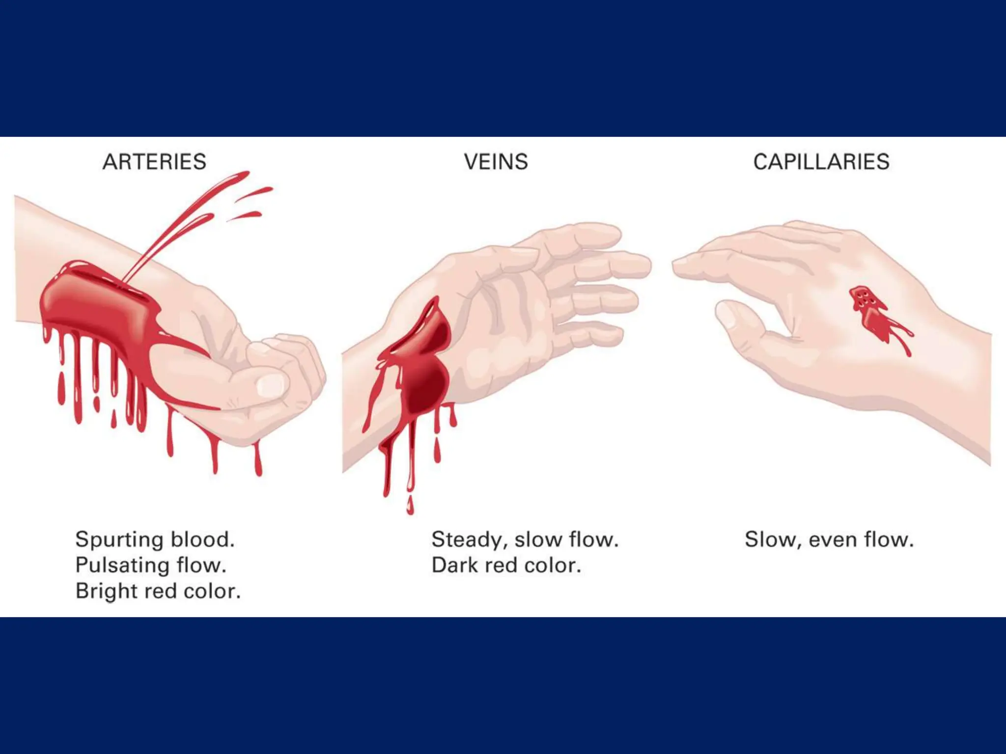 Ch 28 Bleeding and Soft Tissue Injuries.ppt