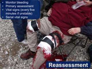 Ch 28 Bleeding and Soft Tissue Injuries.ppt