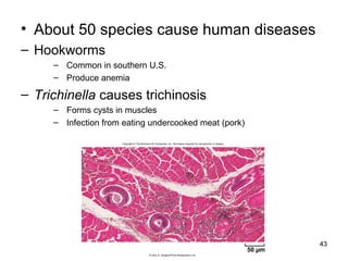 • About 50 species cause human diseases
– Hookworms
– Common in southern U.S.
– Produce anemia
– Trichinella causes trichinosis
– Forms cysts in muscles
– Infection from eating undercooked meat (pork)
43
Copyright © The McGraw-Hill Companies, Inc. Permission required for reproduction or display.
50 µm
© Gary D. Gaugler/Photo Researchers, Inc.
 