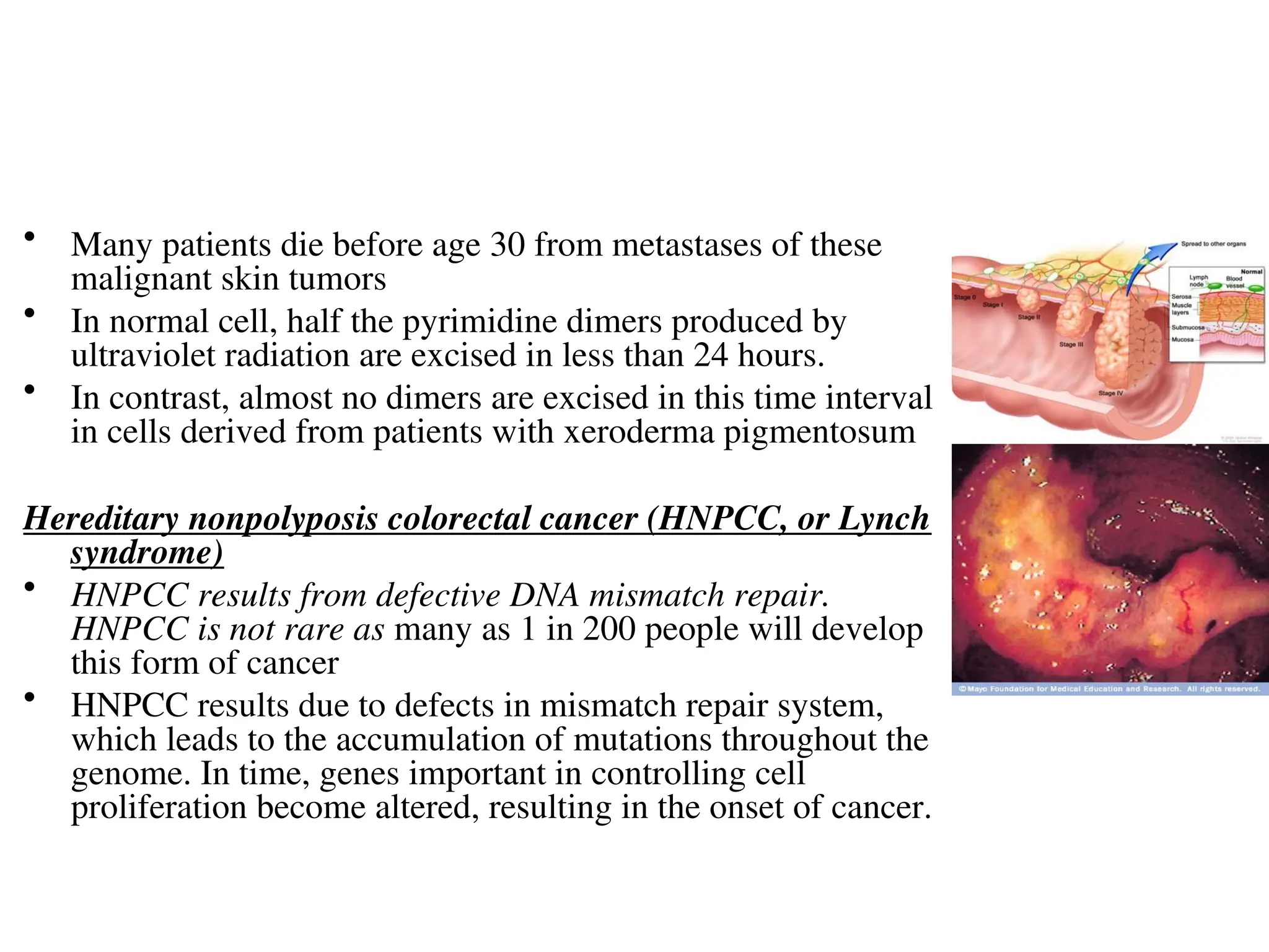 • Many patients die before age 30 from metastases of these
malignant skin tumors
• In normal cell, half the pyrimidine dimers produced by
ultraviolet radiation are excised in less than 24 hours.
• In contrast, almost no dimers are excised in this time interval
in cells derived from patients with xeroderma pigmentosum
Hereditary nonpolyposis colorectal cancer (HNPCC, or Lynch
syndrome)
• HNPCC results from defective DNA mismatch repair.
HNPCC is not rare as many as 1 in 200 people will develop
this form of cancer
• HNPCC results due to defects in mismatch repair system,
which leads to the accumulation of mutations throughout the
genome. In time, genes important in controlling cell
proliferation become altered, resulting in the onset of cancer.
 