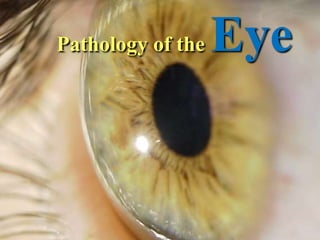 Pathology of the Eye
 