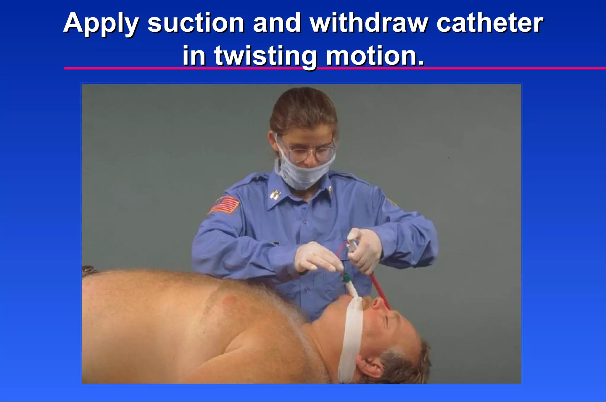 Apply suction and withdraw catheter in twisting motion. 