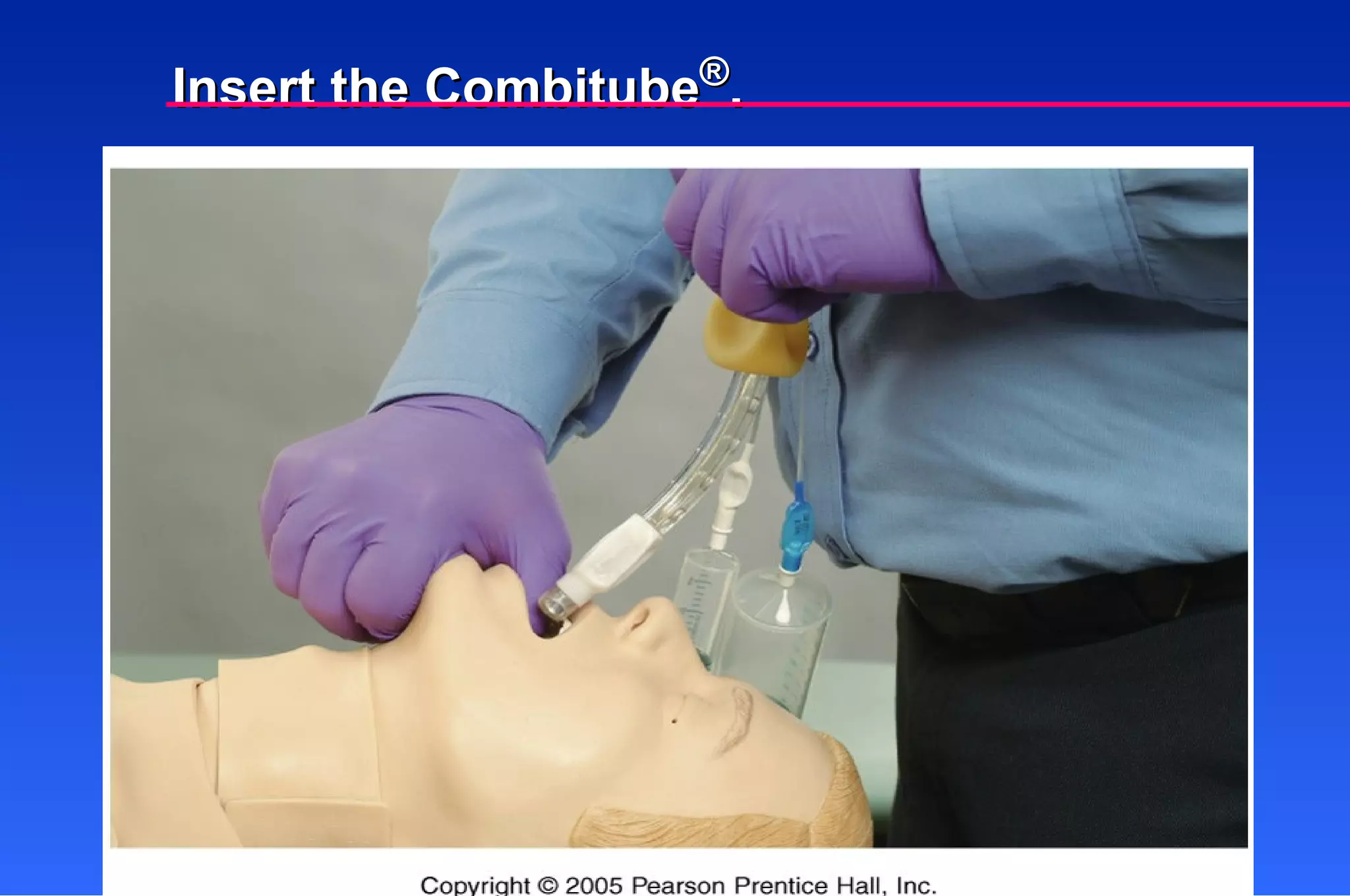 Insert the Combitube ® . 