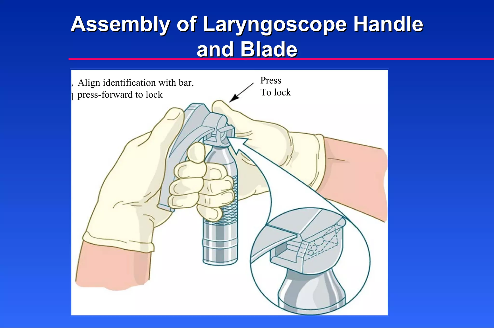 Assembly of Laryngoscope Handle and Blade Align identification with bar, press-forward to lock Press To lock 