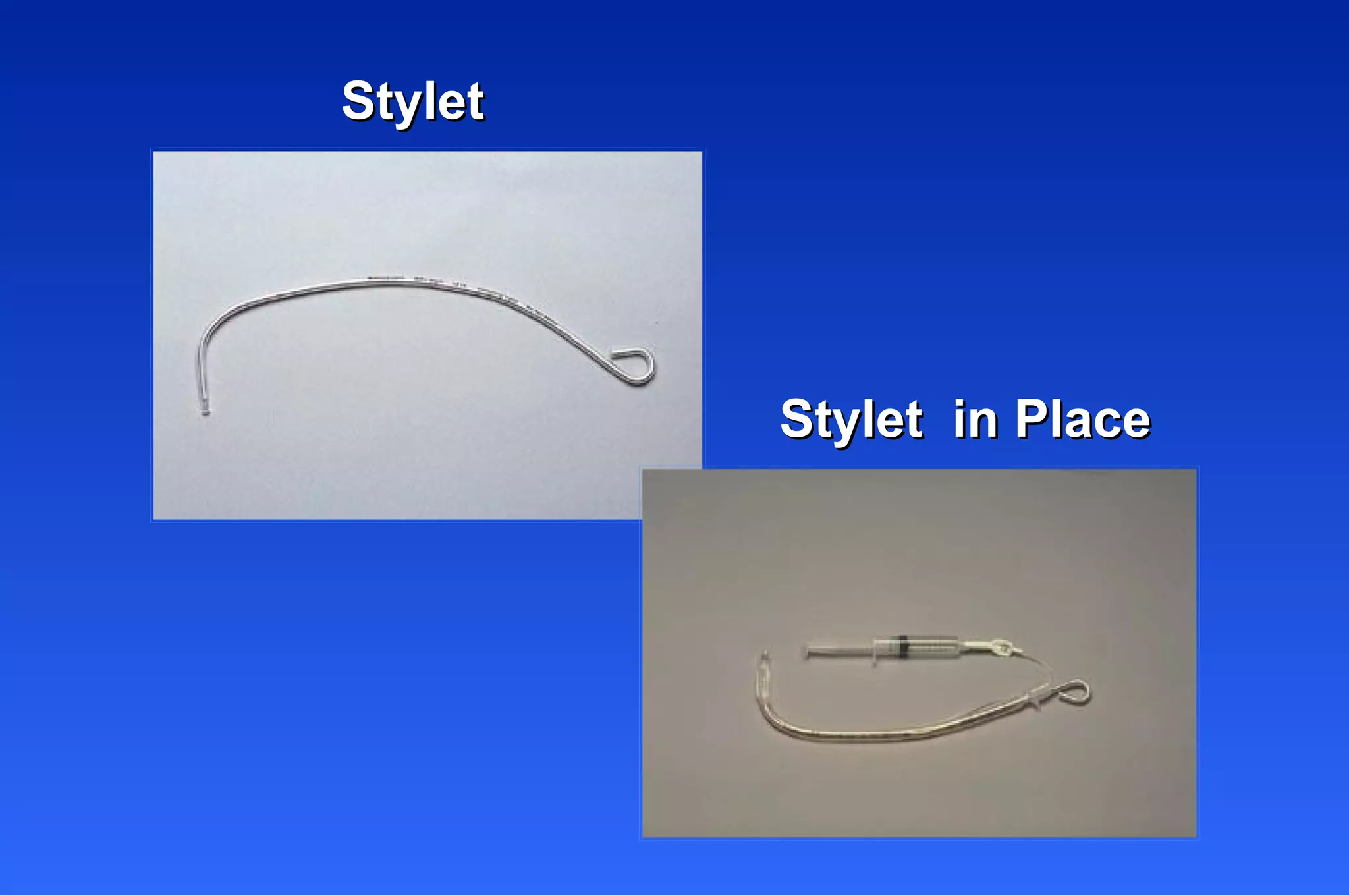 Stylet  Stylet  in Place 