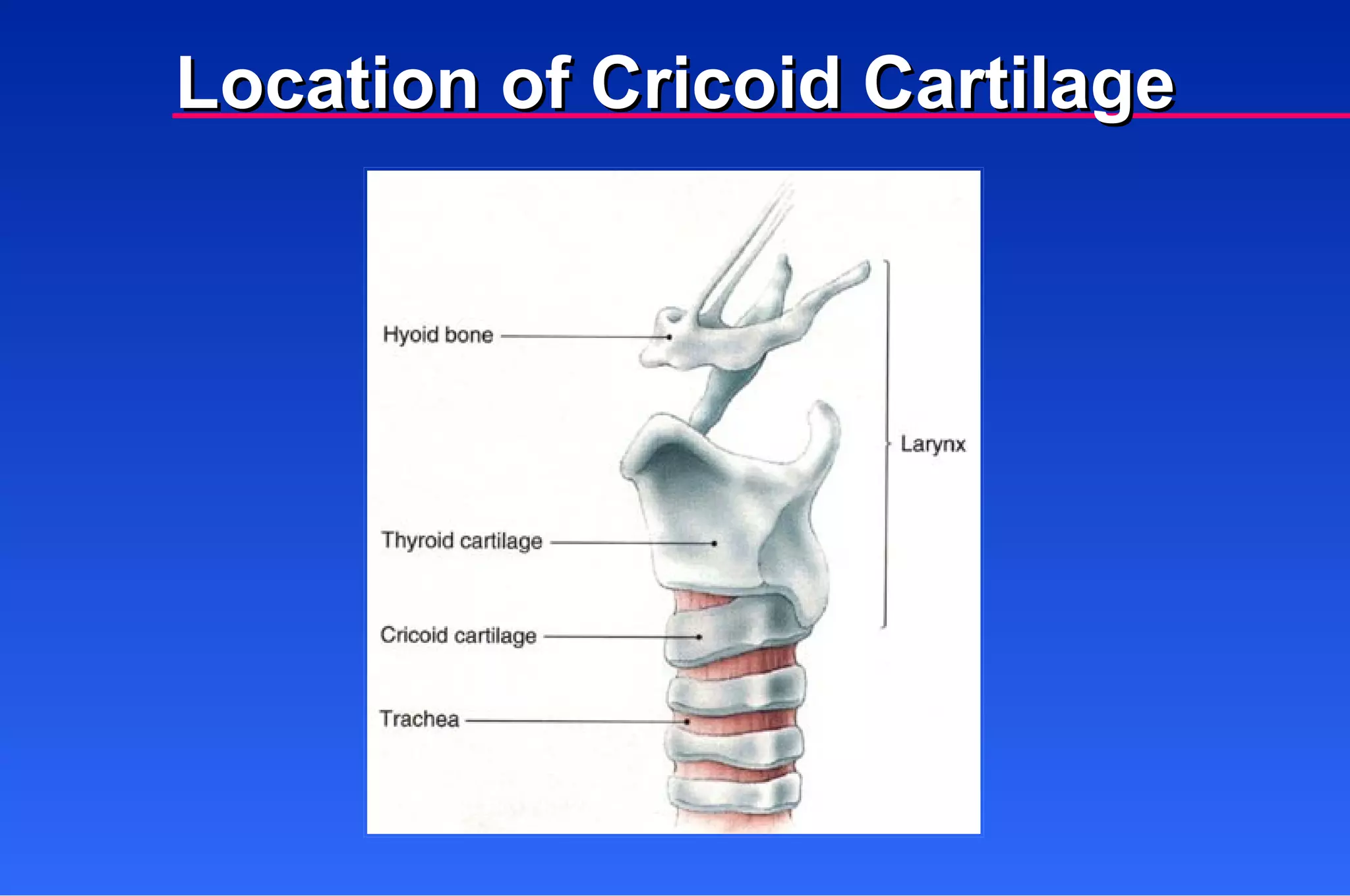 Location of Cricoid Cartilage 