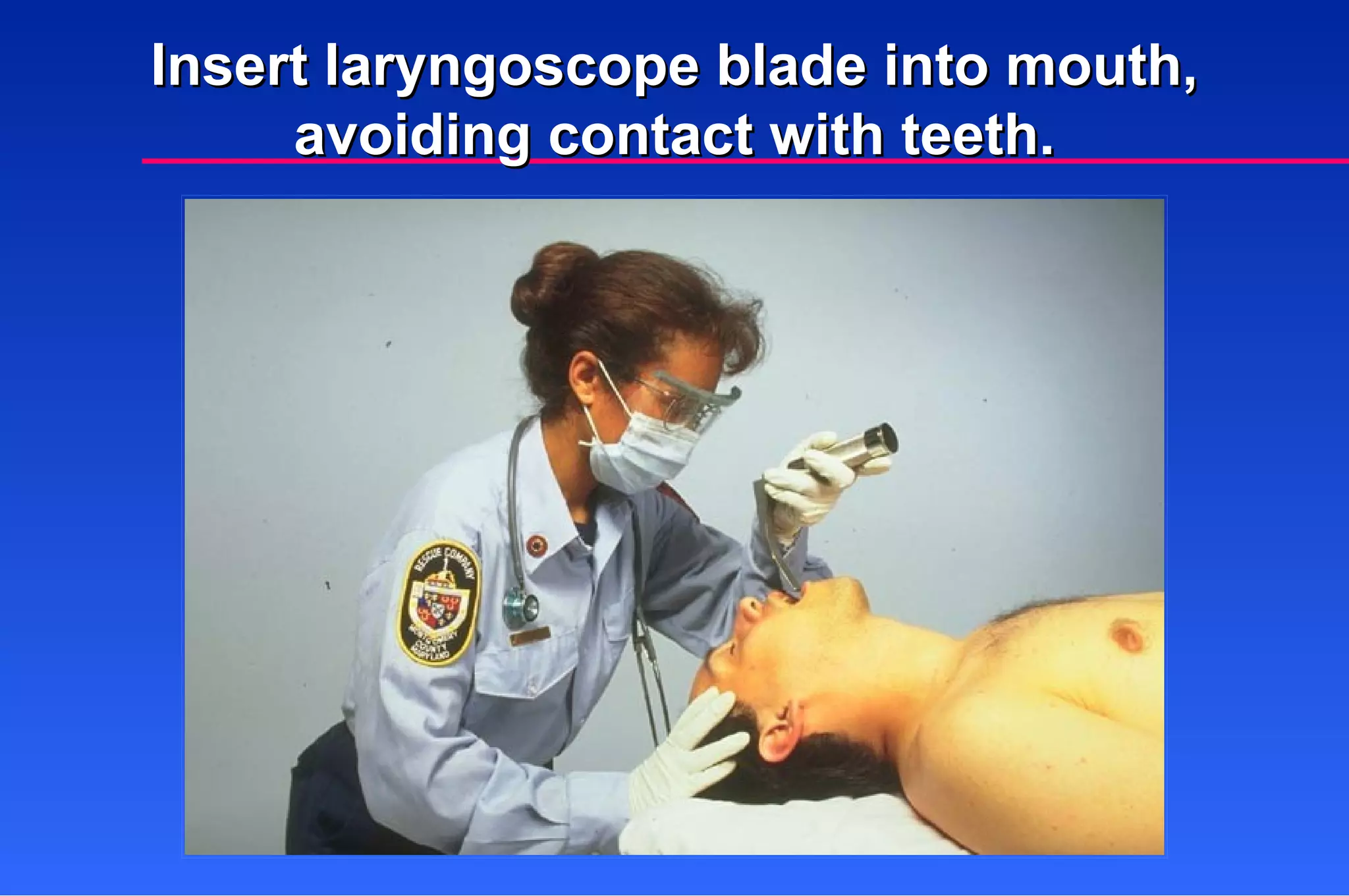 Insert laryngoscope blade into mouth, avoiding contact with teeth. 