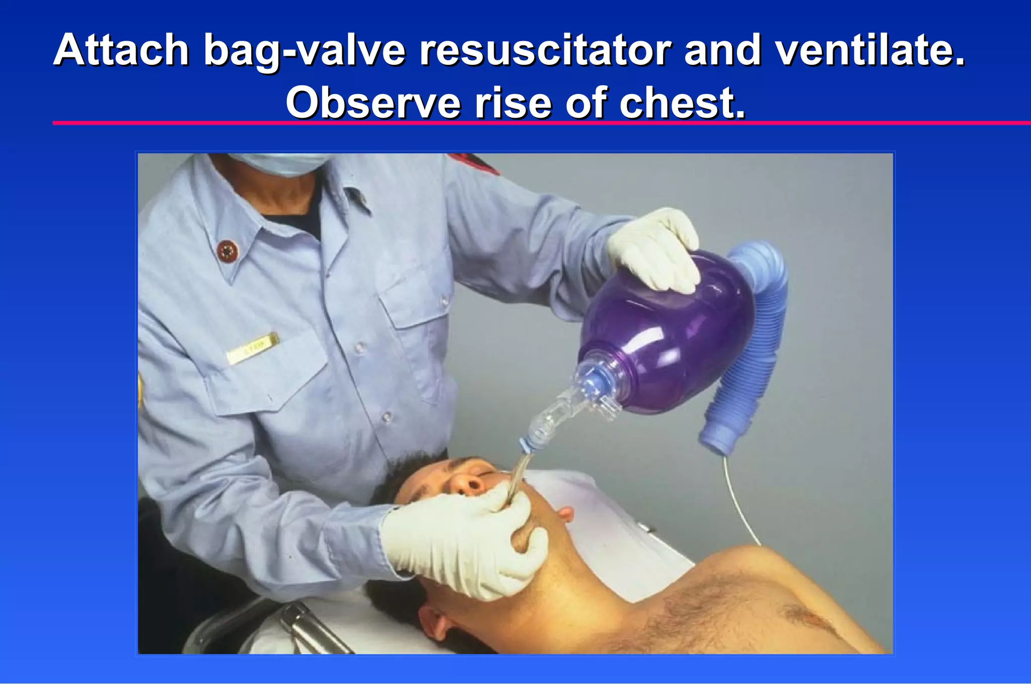 Attach bag-valve resuscitator and ventilate.  Observe rise of chest. 