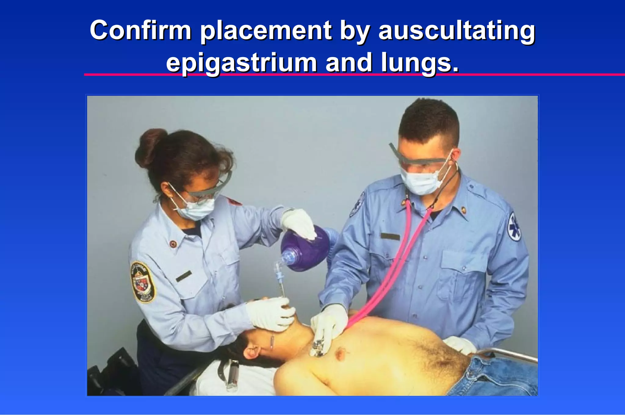 Confirm placement by auscultating epigastrium and lungs. 