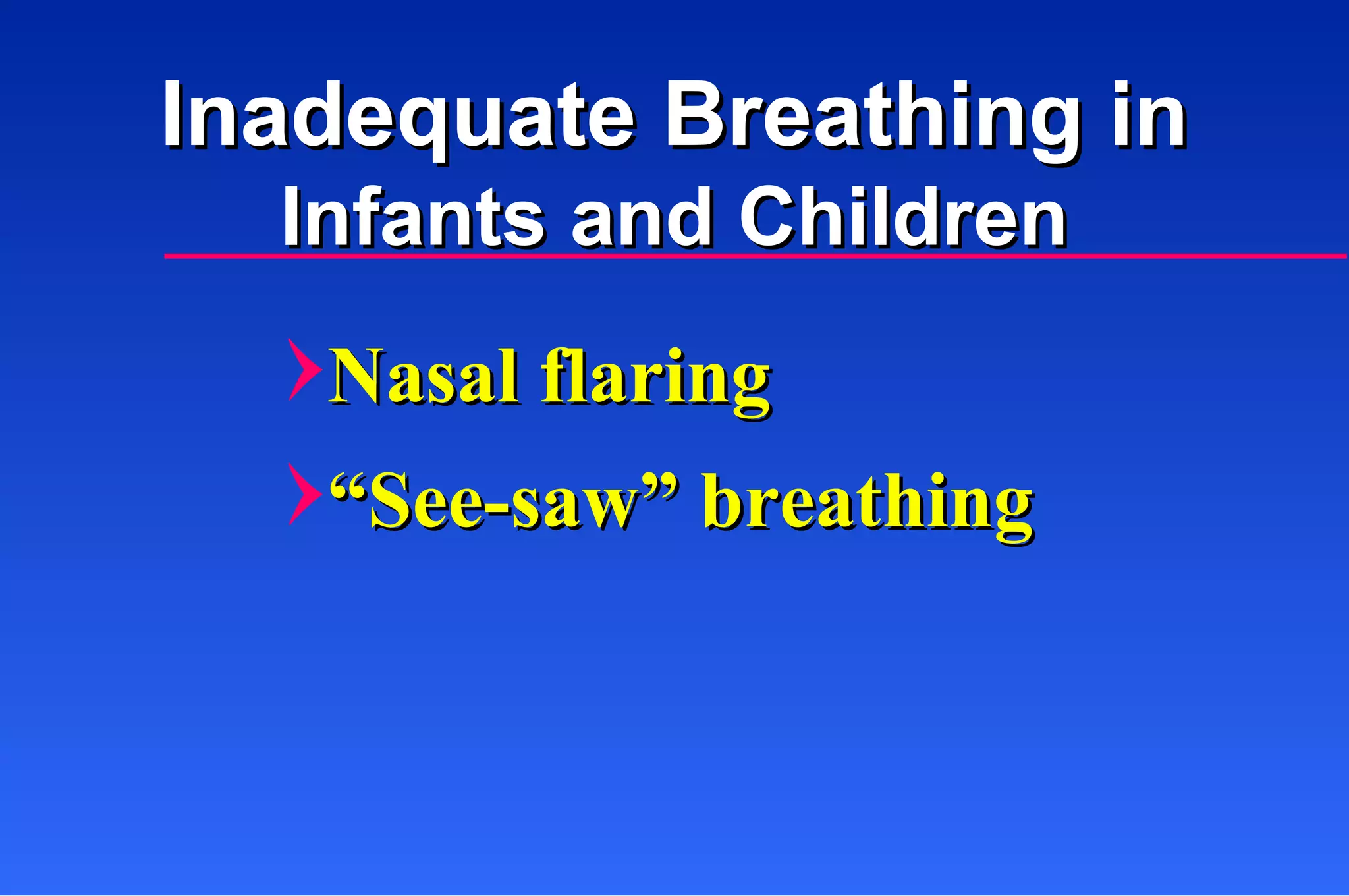 Nasal flaring “ See-saw” breathing Inadequate Breathing in Infants and Children 