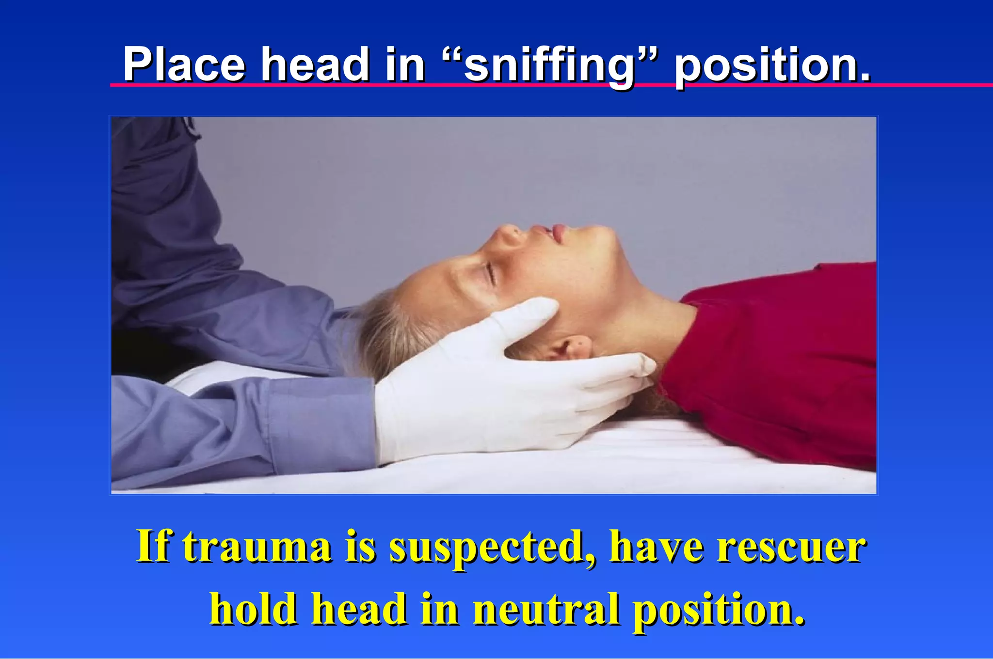 If trauma is suspected, have rescuer  hold head in neutral position. Place head in “sniffing” position. 