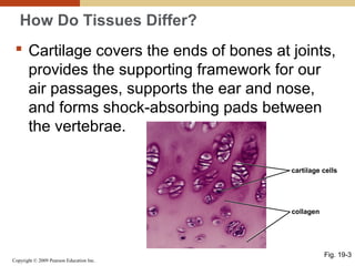 Copyright © 2009 Pearson Education Inc.
How Do Tissues Differ?
 Cartilage covers the ends of bones at joints,
provides the supporting framework for our
air passages, supports the ear and nose,
and forms shock-absorbing pads between
the vertebrae.
Fig. 19-3
cartilage cells
collagen
 