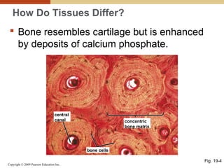 Copyright © 2009 Pearson Education Inc.
central
canal
bone cells
concentric
bone matrix
How Do Tissues Differ?
 Bone resembles cartilage but is enhanced
by deposits of calcium phosphate.
Fig. 19-4
 