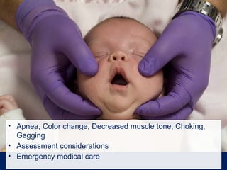 • Apnea, Color change, Decreased muscle tone, Choking,
Gagging
• Assessment considerations
• Emergency medical care
 